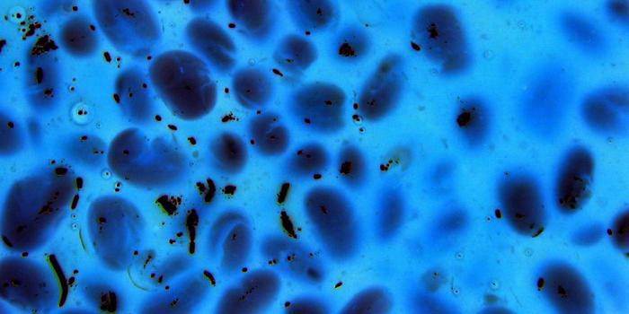 Klebsiella al microscopio