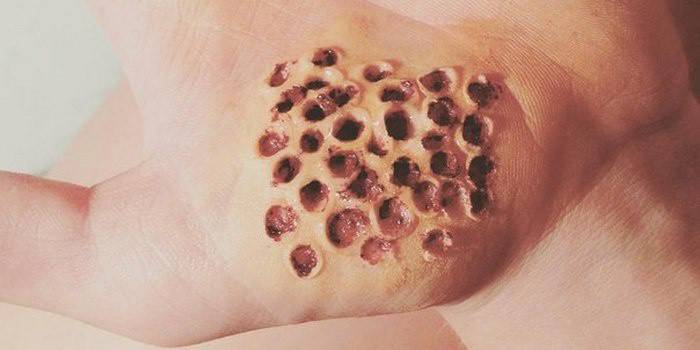 Ant rankos esančios skylių skylės