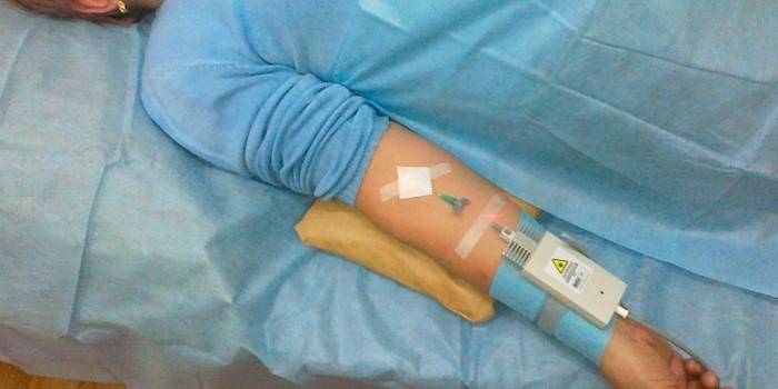 Lazer kan saflaştırması için hazırlık