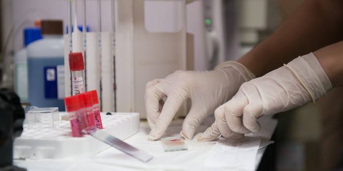 Laboratorinė helminto analizė