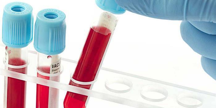 Asinis, kas ņemtas in vitro analīzei