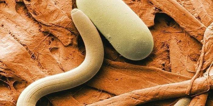 Helminths στο ανθρώπινο σώμα