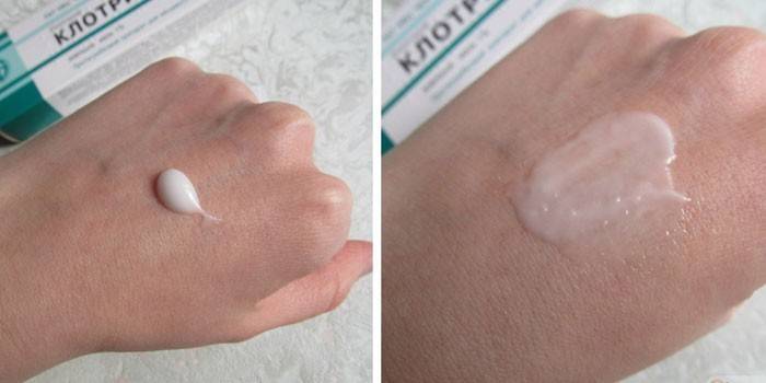 Clotrimazole pomada no braço