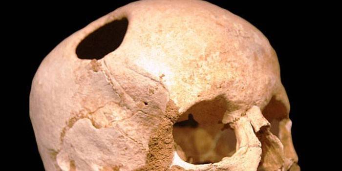 Cráneo humano