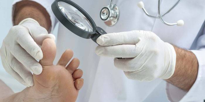 Esame del piede del medico