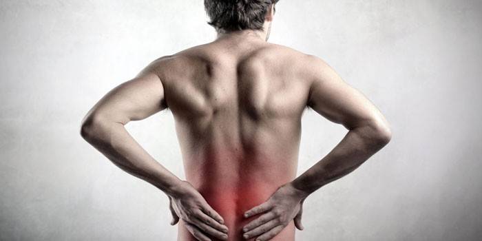 Lumbosacral osteochondrozė