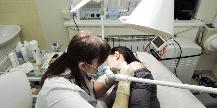 Kosmetologs pacientam veic nevus lāzera noņemšanu