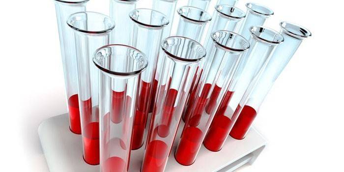 In vitro asins analīzes
