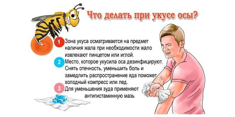 Pirmoji pagalba vapsvų įgėlimui