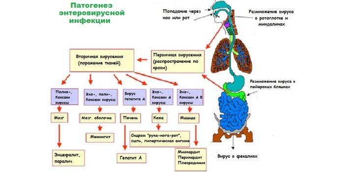 Enterovirusinfektion patogeneesi