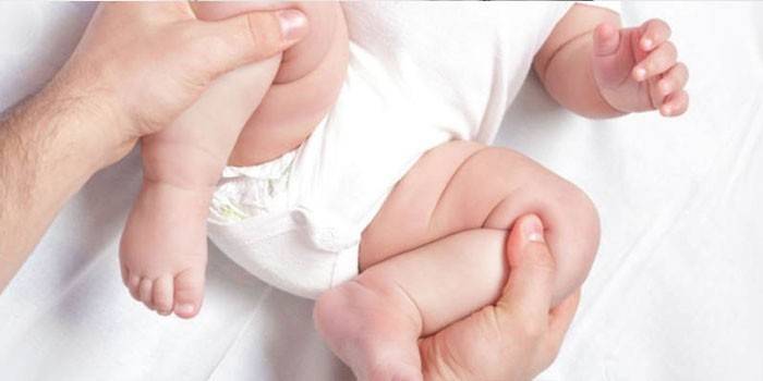 Συγγενής αμφοτερόπλευρη εξάρθρωση των γοφών