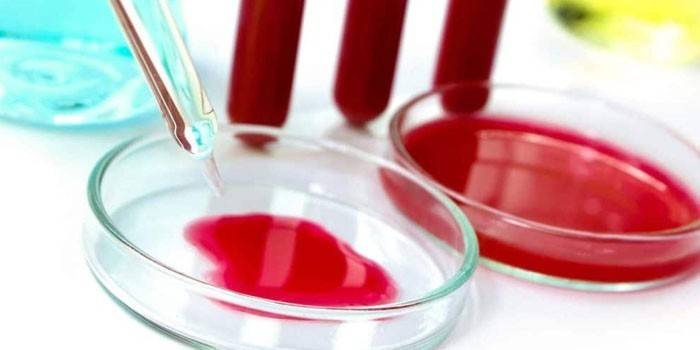 Sangue em placas de Petri