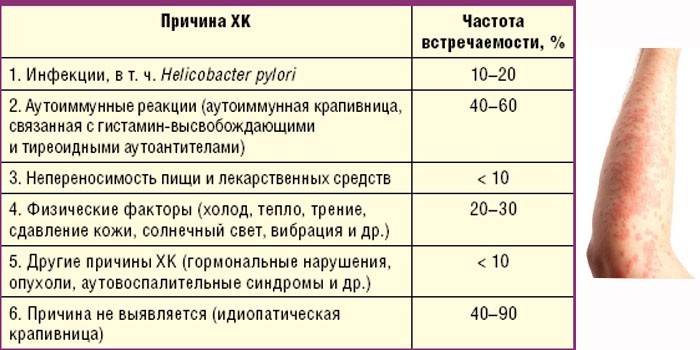 Εκτιμώμενη συχνότητα εμφάνισης διαφόρων αιτιών κνίδωσης