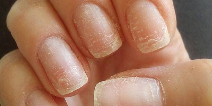 Tấm móng bị ảnh hưởng