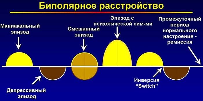 ขั้นตอนความผิดปกติของ Bipolar