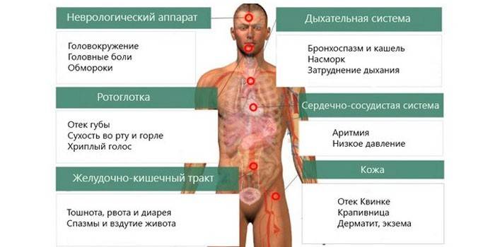 Sintomas de alergia