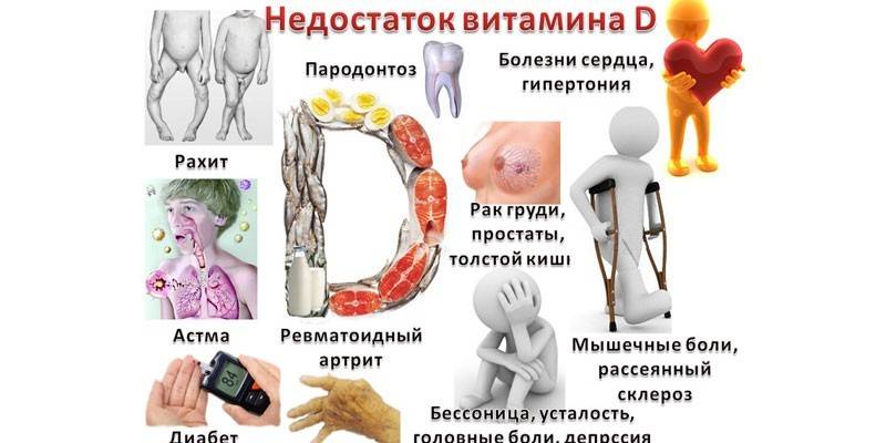 Maladies insuffisantes en vitamine D