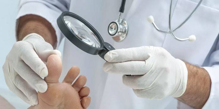 Ο γιατρός εξετάζει τα πόδια του ασθενούς