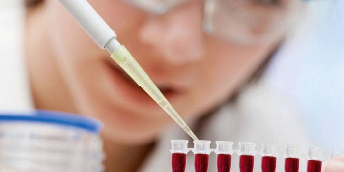 Técnico de laboratorio haciendo un análisis de sangre.