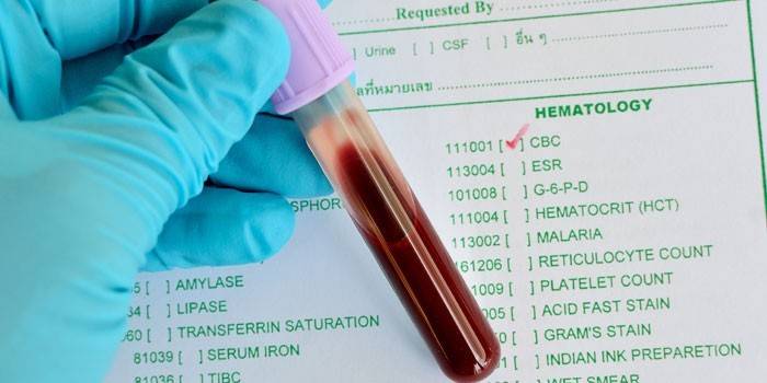 Test sanguin in vitro