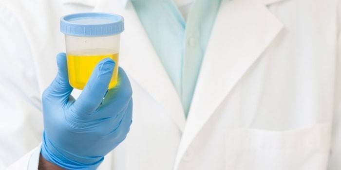 Medikas rankoje laiko indą su šlapimu