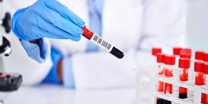 İn vitro kan testleri