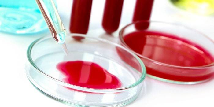 Blut in Petrischalen