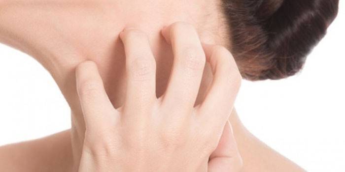 Το κορίτσι έχει φαγούρα στο λαιμό του δέρματος