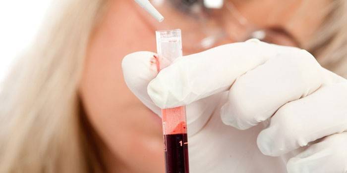 Asistente de laboratorio con un tubo de sangre
