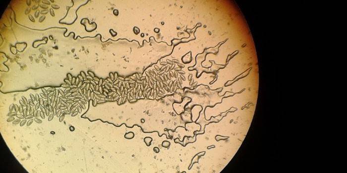 Pinworm tojások a mikroszkóp alatt