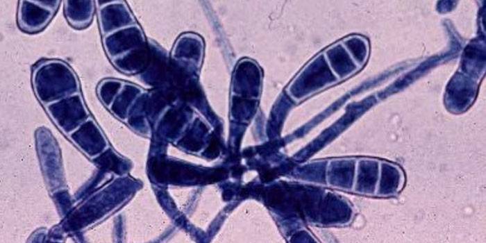 Fungo Epidermophyton floccosum