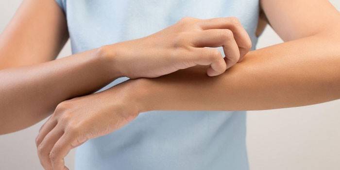 La ragazza ha il prurito della pelle