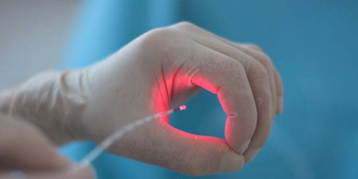 Coagulation laser