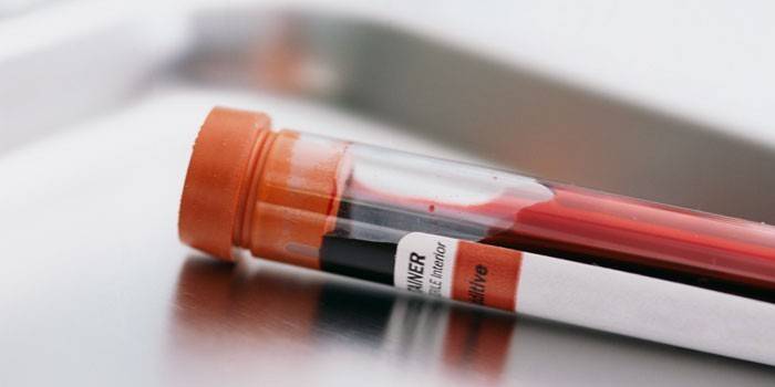 Test de sânge in vitro