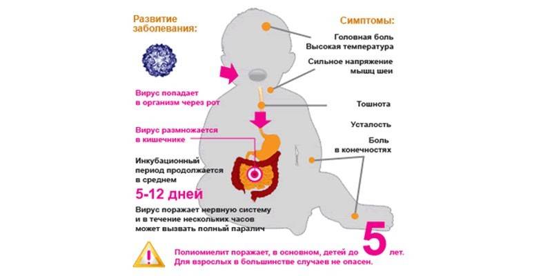 Знаци полио
