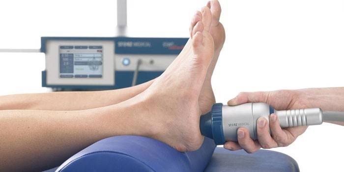 Der Patient wird einer Stoßwellentherapie unterzogen.