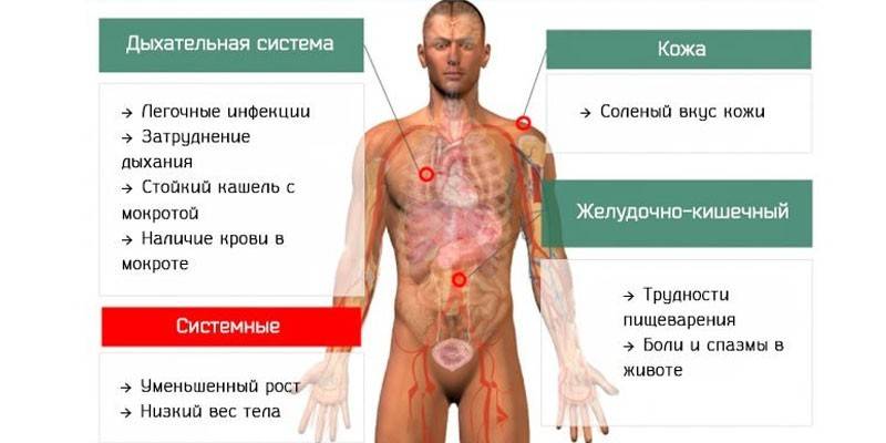 Los síntomas de la fibrosis quística