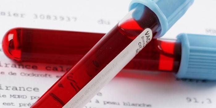 Esami del sangue in vitro