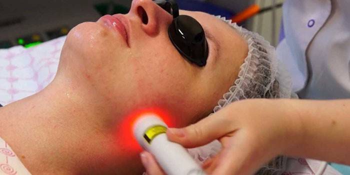 Bio-revitalisation laser
