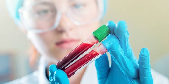 Laboratorijas asinis laboratorijas palīga rokās