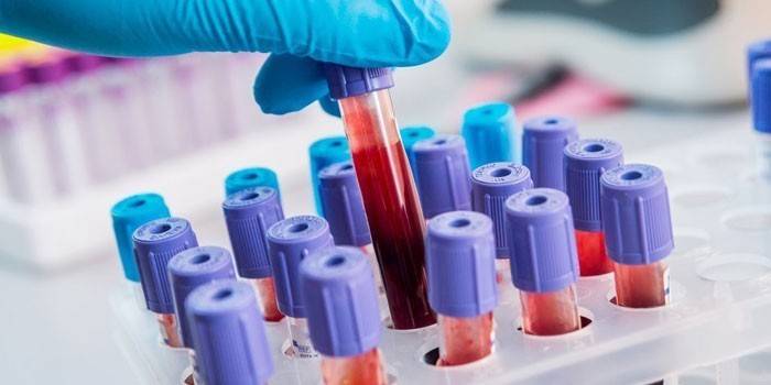 Análisis de sangre in vitro