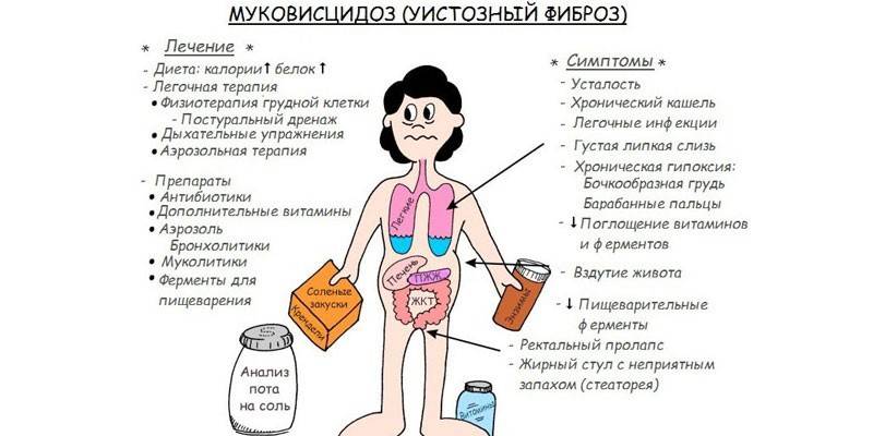 Síntomas y tratamiento de la fibrosis quística en adultos.