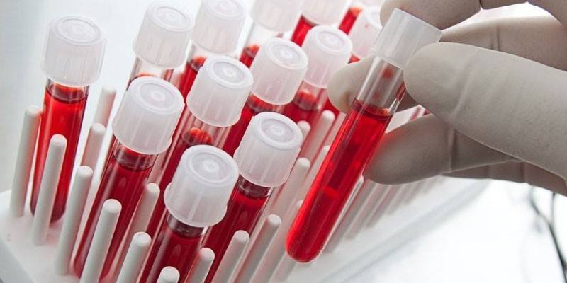 In vitro vérvizsgálatok
