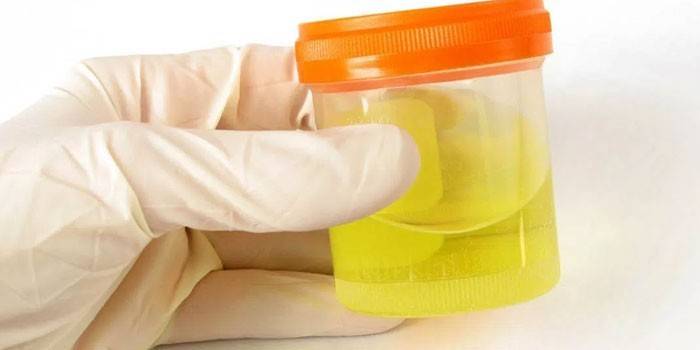 analisi delle urine