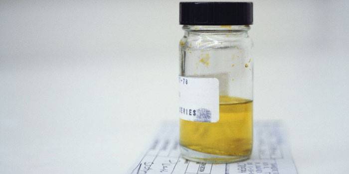 Analisi delle urine in un contenitore