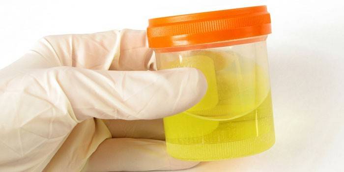 urinalysis