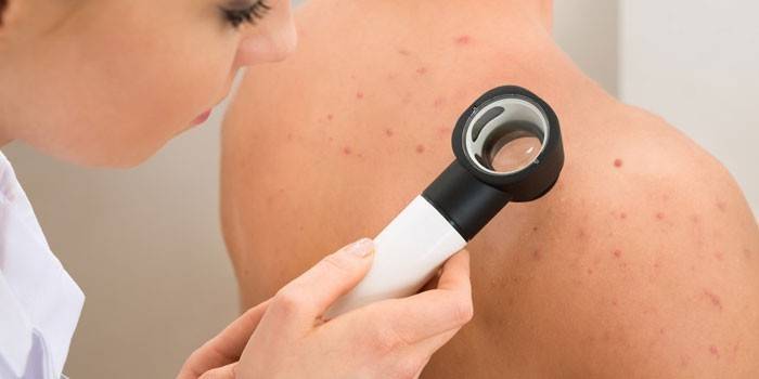 Il medico esamina la pelle del paziente
