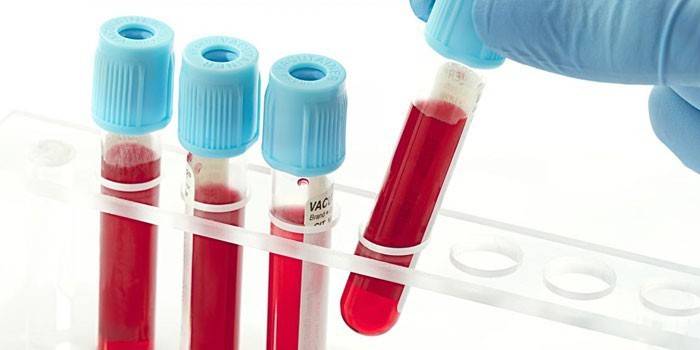 Analize de sânge in vitro