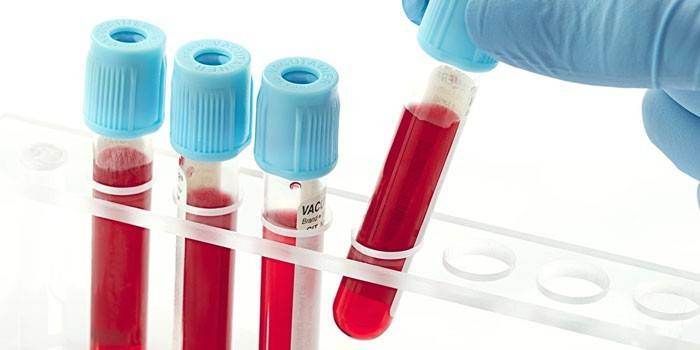 In vitro blodprøver