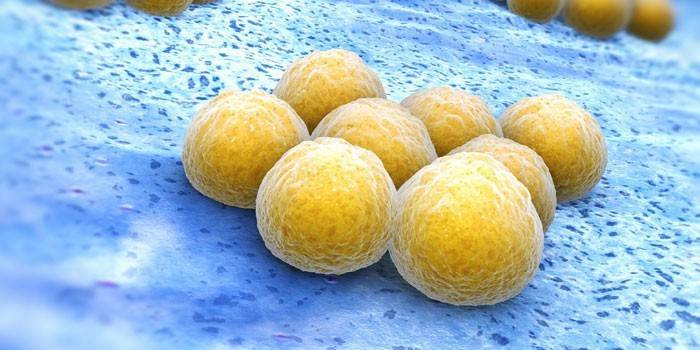 Staphylococcus aureus